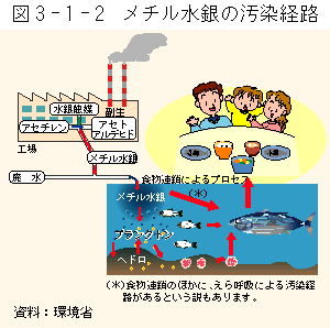 ４大公害病