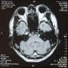 brain080811-02.jpg (104929 oCg)