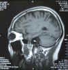 brain080811-03.jpg (95091 oCg)