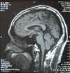 brain080811-04.jpg (107187 oCg)